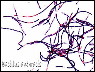 Bacillus anthracis