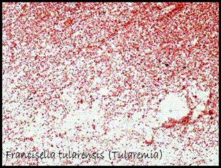 Francisella tularensis (Tularemia)