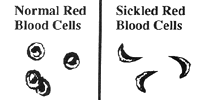 Normal and Sickled Red Blood Cells