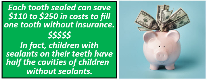 Each tooth sealed can save $110 to $250 in costs to fill one tooth without insurance