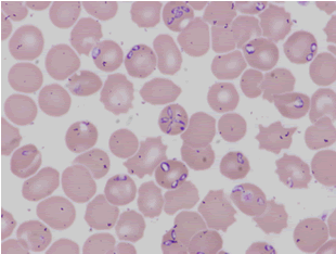 Babesia