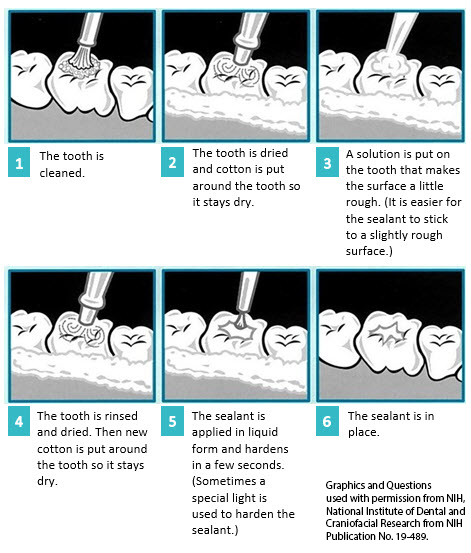 how to apply sealants