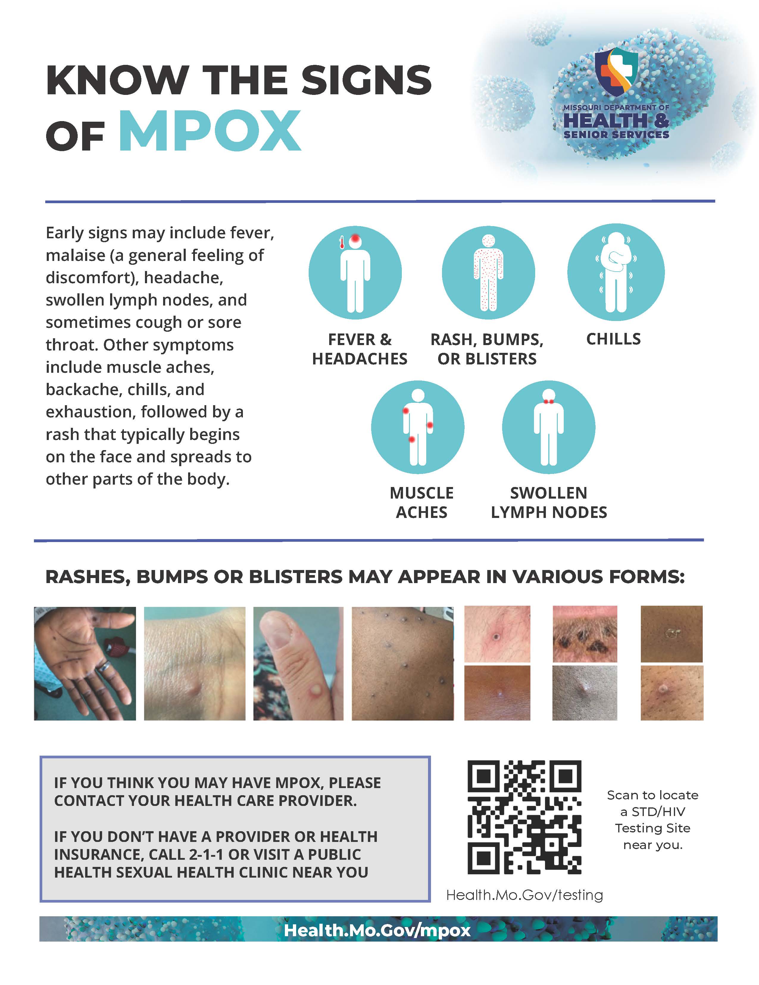 Know the Signs of Mpox