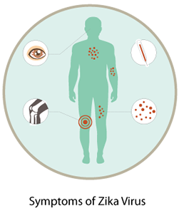 picture describing symptoms on the human body: red eyes, fever, joint pain, rash