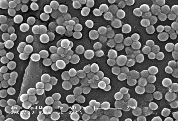 Extremely tough bacteria's resistance under the microscope