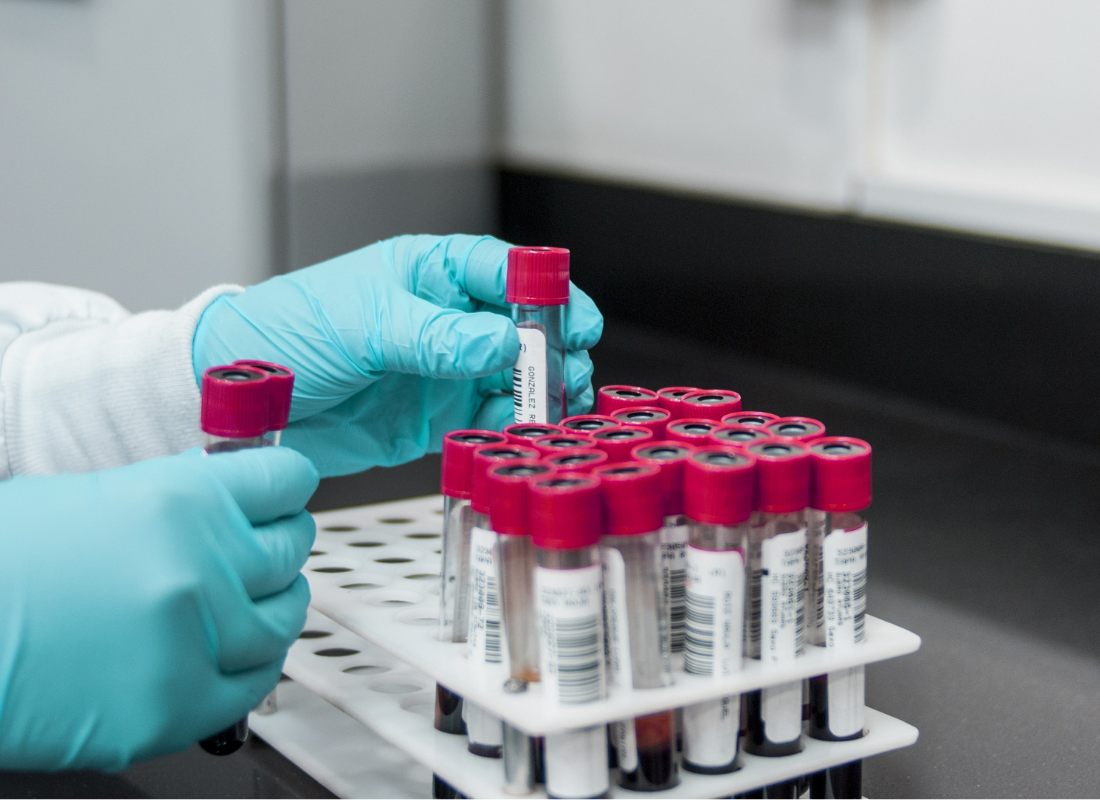 Test tubes of blood to be tested.