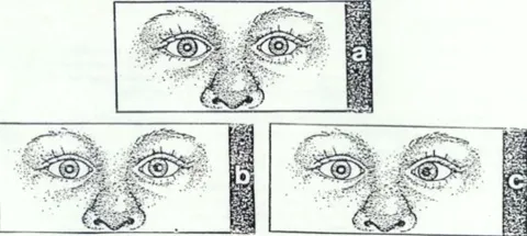 The position of the light on the cornea or pupil may be used to detect strabismus.