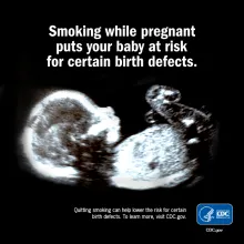 birth-defects-fb-mar-2026.png