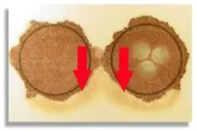 serum-rings